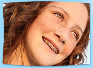 teen girl with braces